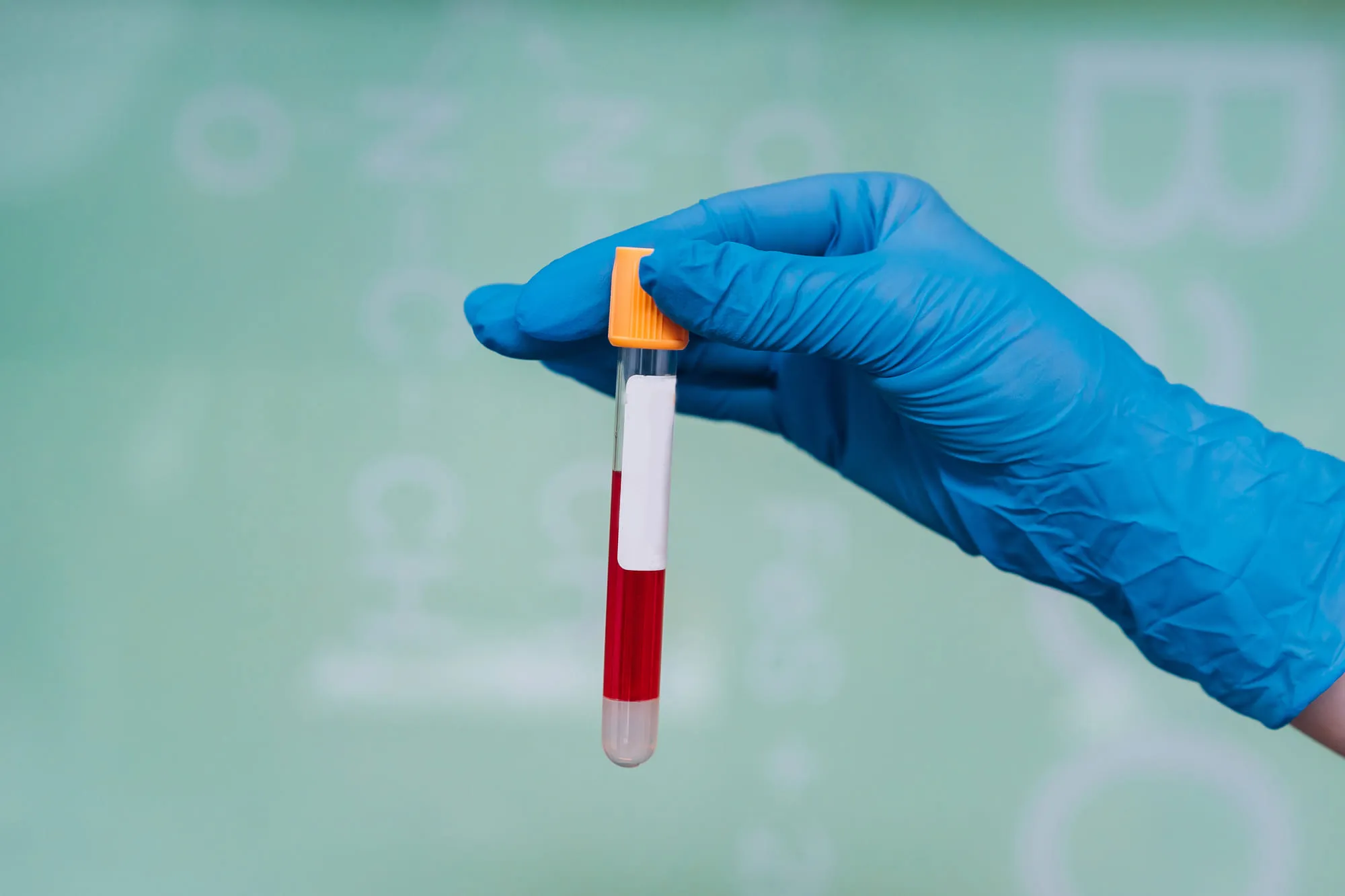 A gloved hand holding a labelled blood sample tube for laboratory testing